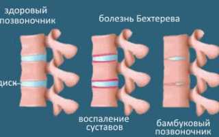 Лидаза: инструкция по применению в уколах, особенности средства, его плюсы и минусы