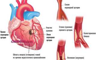 Почему жжет в области сердца