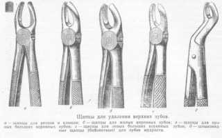 Разновидности щипцов для удаления зубов