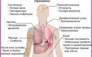 Клетки миелоидного ряда