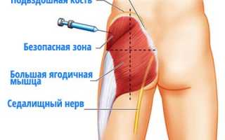 Инструкция по применению Мовасина