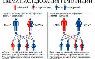 Гемофилия: общие сведения о заболевании