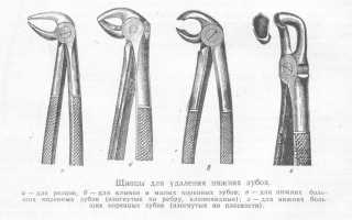 Инструменты для удаления зуба